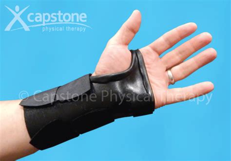 Hand Therapy Splints Capstone Physical Therapy