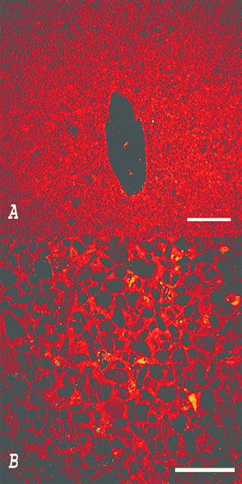 A Thin Section Photo Of Coarse Siltstone In Carbonate Concretion