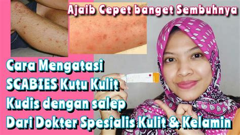 CARA MENGATASI SCABIES OBAT TUNGAU PADA MANUSIA RinTans YouTube