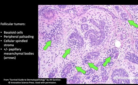 Jerad Gardner Md On Twitter Rt Christinejkomd Vincenzopolizz Yes