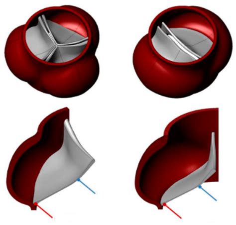 Fluids Free Full Text FluidStructure Interaction Aortic Valve