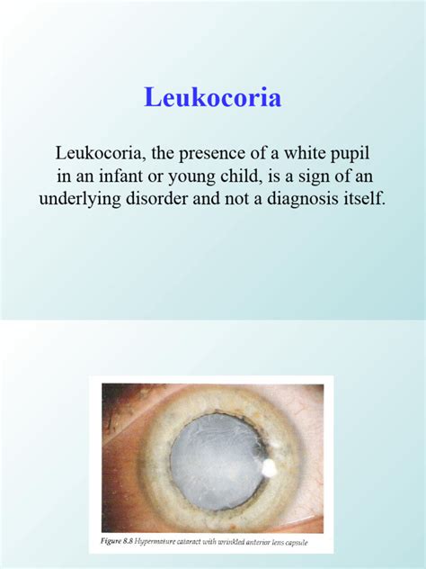 Leukocoria of Dermatology Sana'a University | PDF | Medicine | Human ...