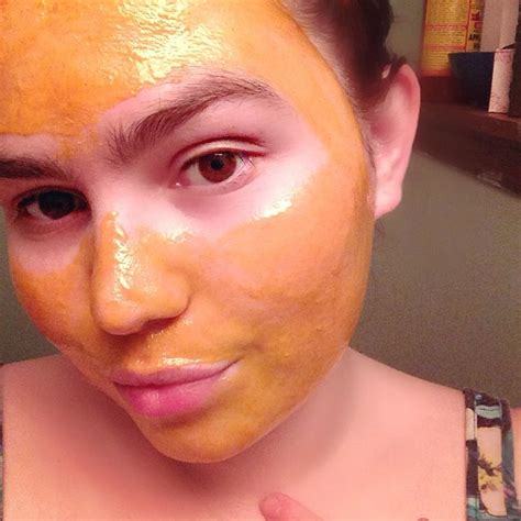 Diy Emergency Face Mask For Dermatitis Eczema Acne And Irritation Beauty By Britanie