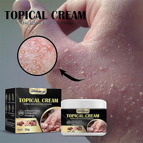 Mja 30g Psoriasis Cream Eczema Ointment Scalp Psoriasis Hand Tinea Foot