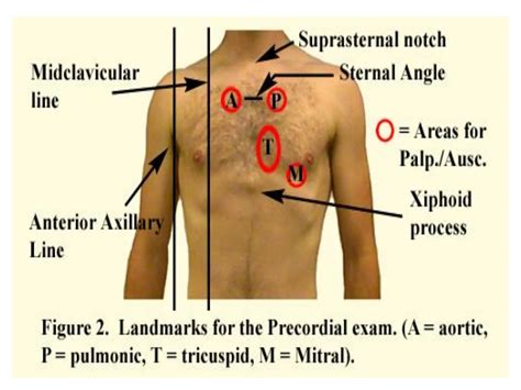 Heart And Chest Auscultation And Heart Sounds Ppt