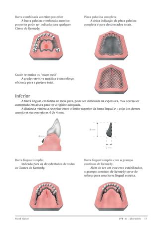 Pr Tese Parcial Remov Vel Odontol Gico Pdf