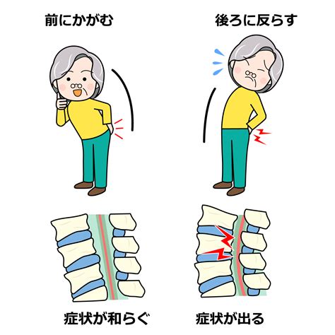 脊柱管狭窄症とは？症状や原因、治し方について徹底解説！ 名古屋の鍼灸接骨院・ハートメディカルグループ