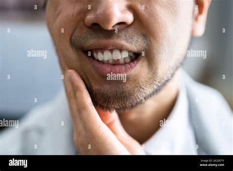 Sore Tooth And Decay Man Dental Health Stock Photo Alamy