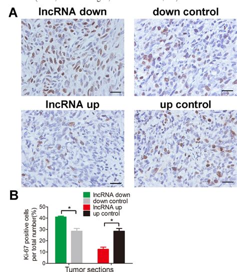 Figure 5 From Long Non Coding RNA RAB11B AS1 Prevents Osteosarcoma