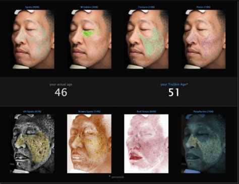 Visia Skin Analysis Victorian Cosmetic Institute