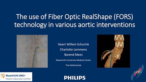 Fiber Optic Realshape Fors Technology Research Philips