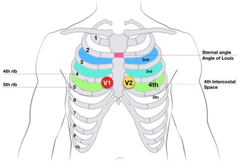 Angle Of Louis Sternal Angle 4th Intercostal Space V1 V2 Placement