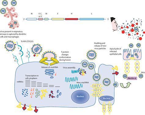 Measles The Lancet