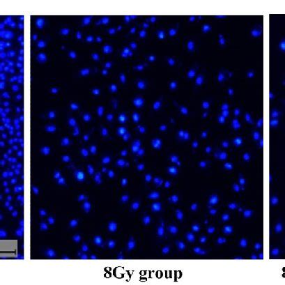 Hoechst 33258 And PI Staining In Cultured HUVEC Cells Representative