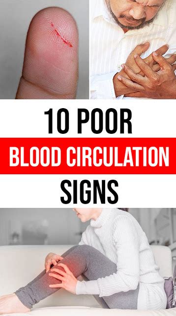 Poor Blood Circulation Signs Are Your Papercuts Taking Way Too Long