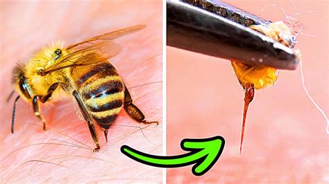 Why Bees Dont Survive After Stinging You And Other Cool Facts About