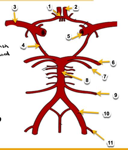 Neuromuscular 2 Stroke CVA Lecture Flashcards Quizlet