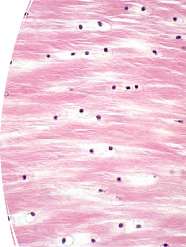 Pathology Of Bone And Msk System I Ii Flashcards Quizlet