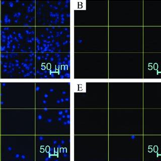 Cxre Reduced The Viability Of Hone Cells After H Hone Cells