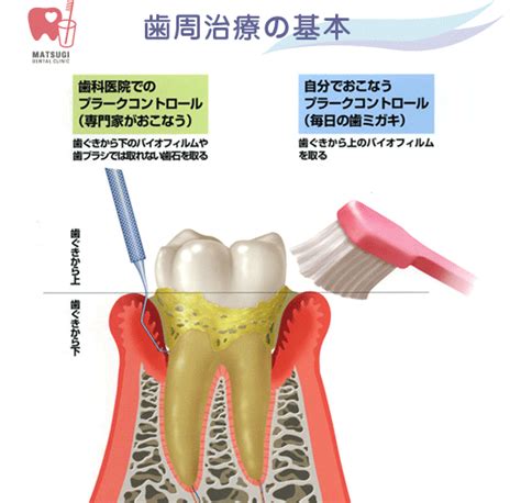 歯周病治療 松木歯科医院 高知県高知市 虫歯予防・小児歯科にチカラを入れている歯科・歯医者さん