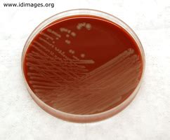 Pasteurella Multocida Human Infection