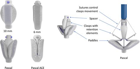 The Pascal Transcatheter Valve Repair System A Users Guide