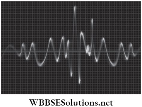 Neet Foundation Notes For Physics Chapter Sound Wbbse Solutions