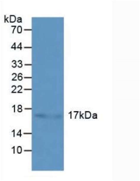 Invitrogen HSPB3 Polyclonal Antibody Invitrogen 100 μL Unconjugated