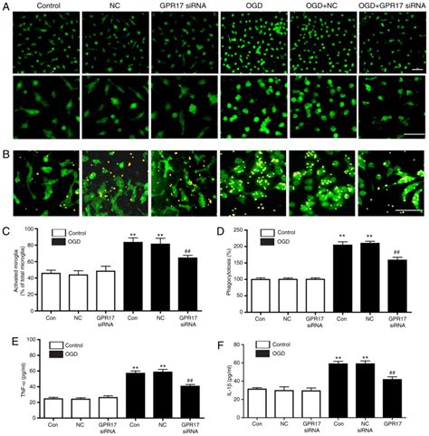 Gpr17 Mediates Ischemia Like Neuronal Injury Via Microglial Activation