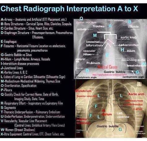 Chest Radiograph Medizzy