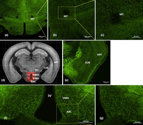 Neuroanatomy Of Melanocortin 4 Receptor Pathway In The Mouse Brain