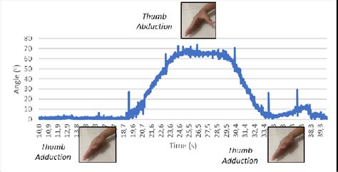 Slow thumb abduction-adduction movement | Download Scientific Diagram