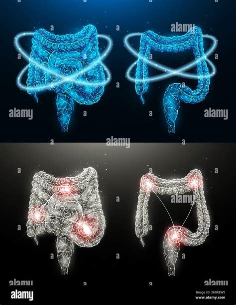 Medicina Per Il Trattamento Della Sindrome Dell Intestino Irritabile