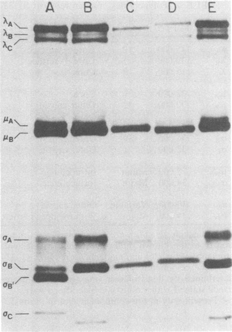 Autoradiogram Of 35s Methionine Labeled Structural Polypeptides Of