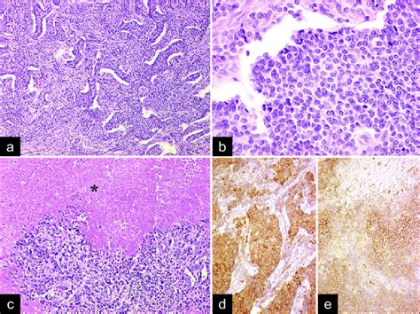 Panel Of Representative Photomicrographs Showing A Trabecular