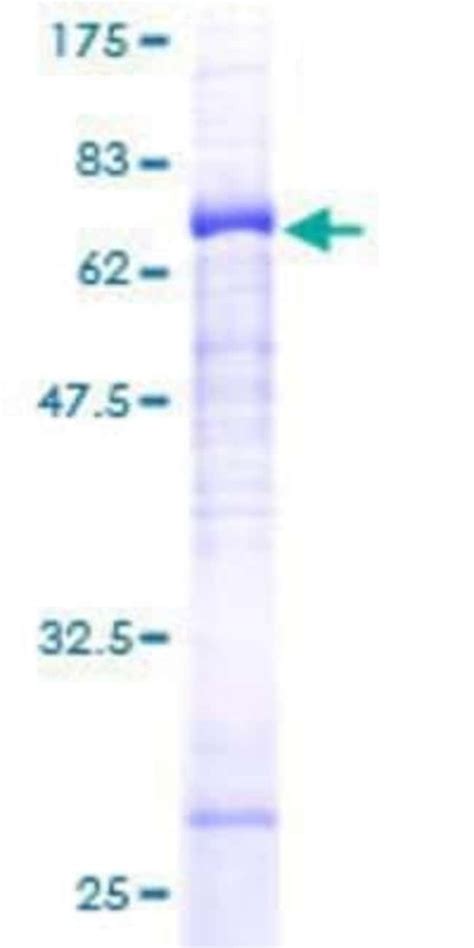 Novus Biologicals Recombinant Human Glycine Receptor Alpha 3 GST N