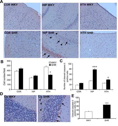 Immunohistochemical Evaluation Of Cleaved Caspase 3 Expression In The