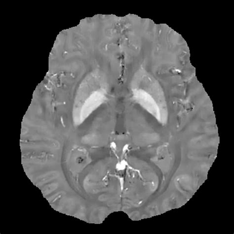 Cornell Mri Research Lab Research Interests