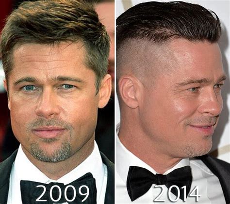 Brad Pitt Face Before And After Brad Pitt Celebrity Plastic Surgery