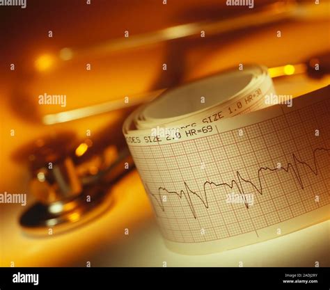 ECG et stéthoscope Électrocardiogramme ECG de trace et d un