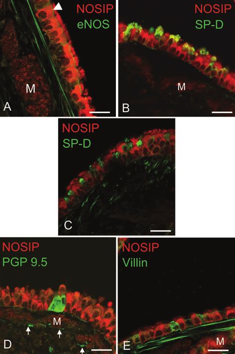 Double Labeling Immunohistochemistry For Nosip And Epithelial Markers