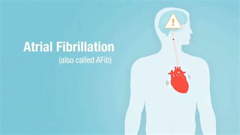 What Is Atrial Fibrillation Go Red For Women