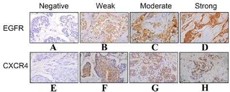 Immunohistochemical Staining Of Ad Egfr And Eh Cxcr Expression