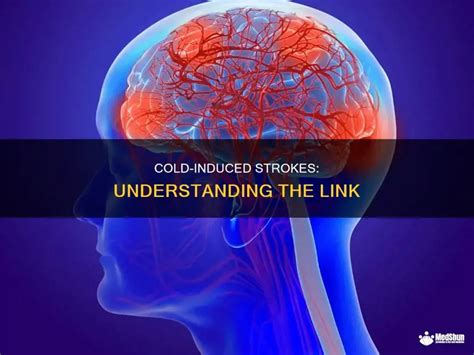 Cold Induced Strokes Understanding The Link Medshun