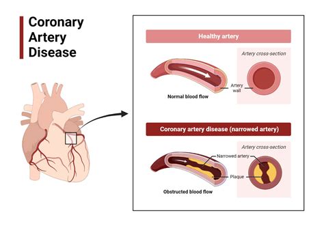 Arteries Structure Types Functions And Common Diseases