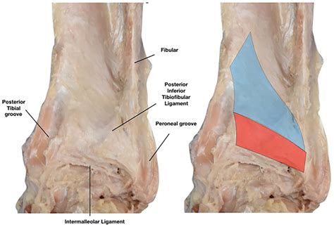 Anatomy Of The Insertion Of The Posterior Inferior Tibiofibular