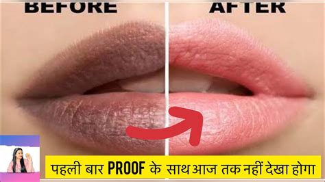 How to Get rid of Dark Lips Naturally 100 Natural 7 Easy DIY सरदय