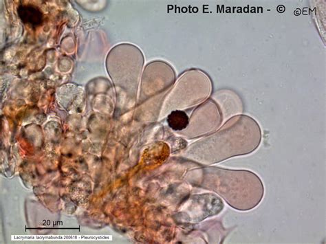 Microscopie Cystides De Lacrymaria Lacrymabunda Psathyrella Velutina