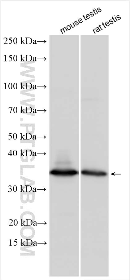 Stx17 Antibody 17815 1 Ap Proteintech 武汉三鹰生物技术有限公司