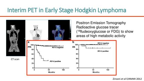 Treatment Escalation In Patients With Early Stage Hodgkin Lymphoma And